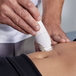 CICATRICI E USTIONI thumbnail