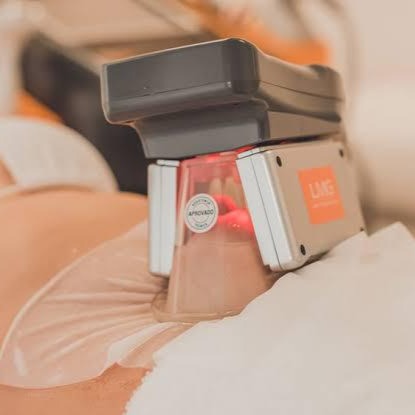 Criolipólise thumbnail