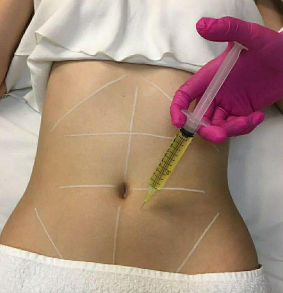 Aplicação de Enzimas thumbnail