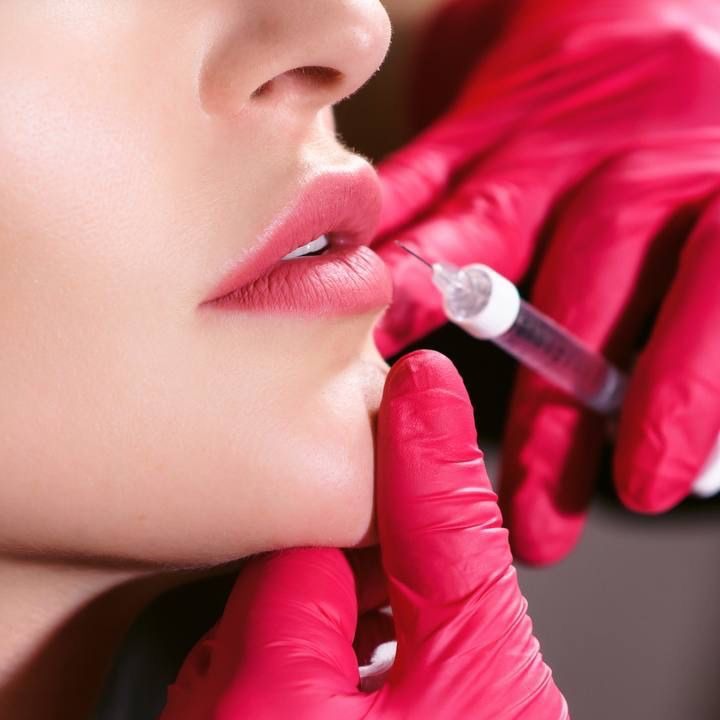 Preenchimento Labial thumbnail