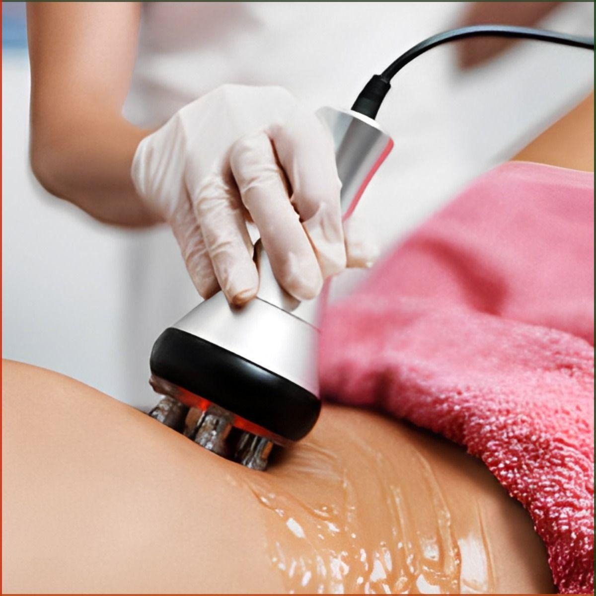 Radiofrequência thumbnail