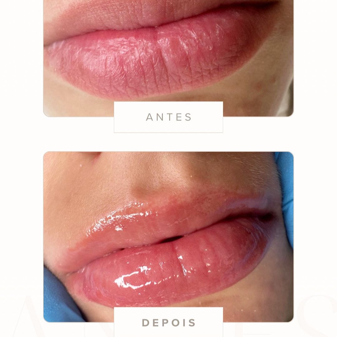 HIDRAGLOSS - 60€ thumbnail