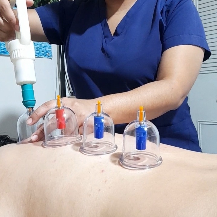 Cupping Terapéutico (Complemento) thumbnail