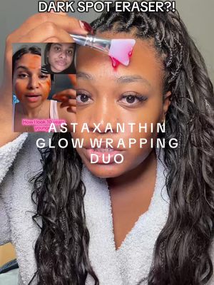 Now THIS is the hyperpigmentation bundle we all need. 🙌🏾 #darkspots #hyperpigmentation #koreanskincare #melaninskincare 