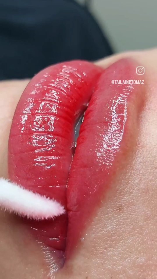 💋 Cor de Melancia dos Sonhos! 🍉🌟
Micropigmentação labial per-fei-ta com lábios hidratados e naturais.
A técnica que dese