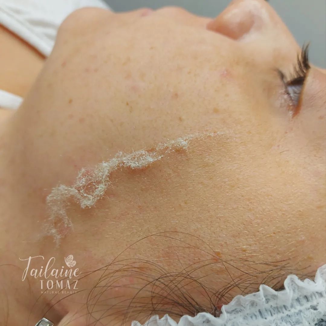 Nessa época de extremo calor sua pele fica com aspecto envelhecido?
 
O acúmulo de sujidade, impurezas, células mortas, 