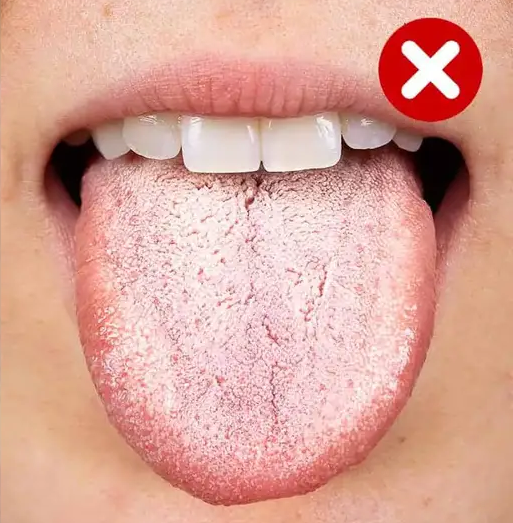 Get Rid of Bad Breath & Eliminate Tongue Coating  in Just 1 Step thumbnail