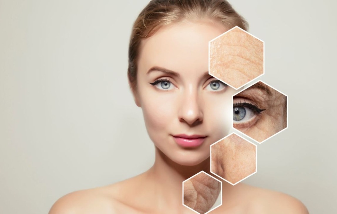 Botox thumbnail