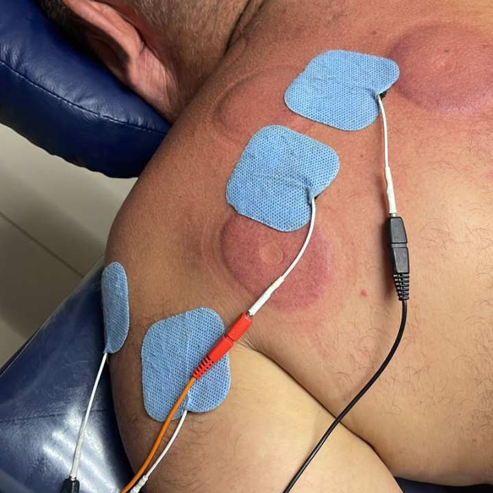 Reabilitação - Fisioterapia em Geral thumbnail