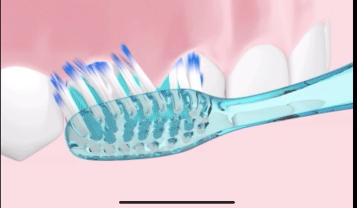 This is how you brush the gum line 🪥
A patient recently told me that when she brushes her teeth she feels like the 45 de