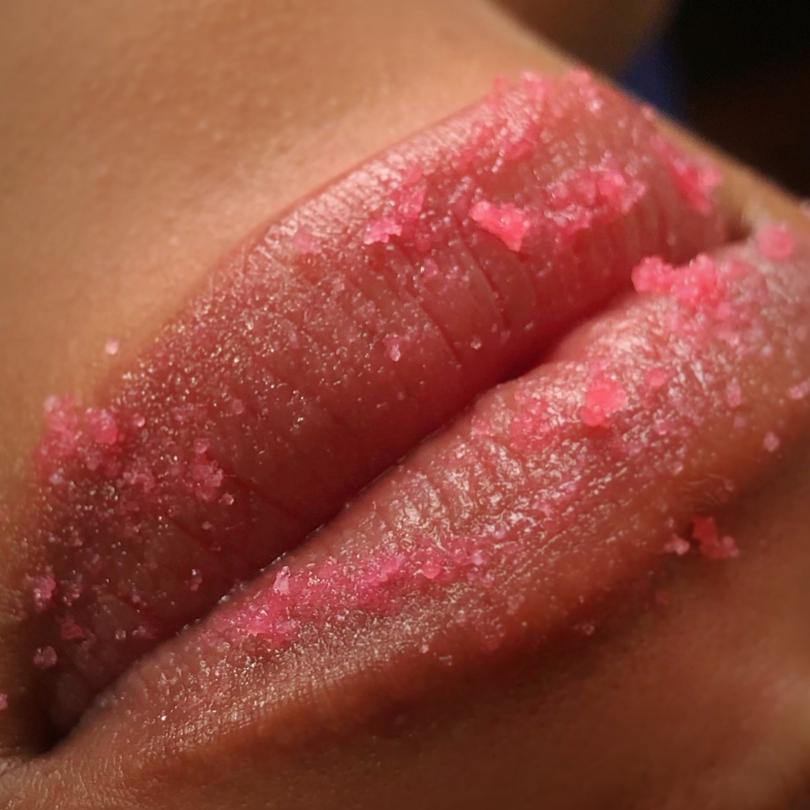 Detalhes de uma Esfoliação dos lábios 🫦
-
-
#spalabial #lábiosperfeitos #revitalizaçãolabial #joinville #atendimentoadom