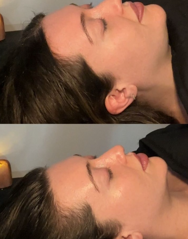 Snatch Facial thumbnail