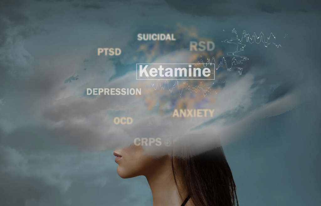 Ketamine for Depression Cost: A Detailed Guide to Ketamine Pricing thumbnail