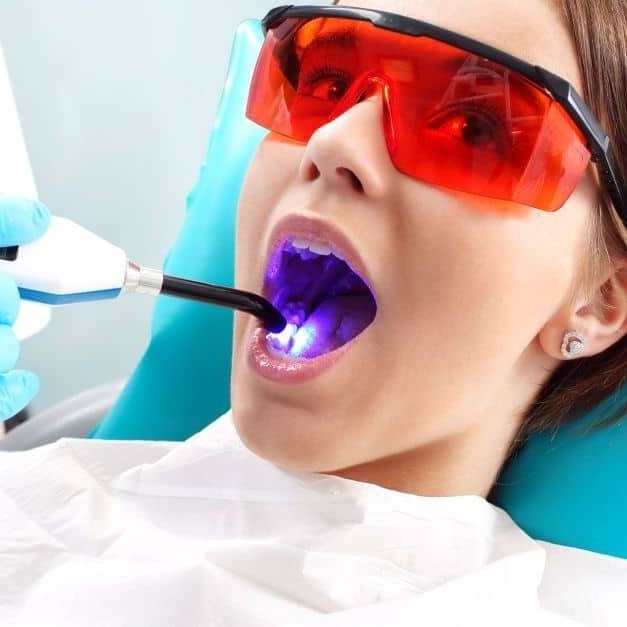 Laser Odontológico thumbnail