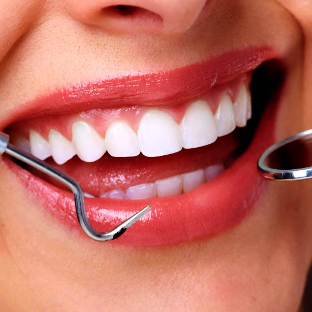 Estética Dental thumbnail