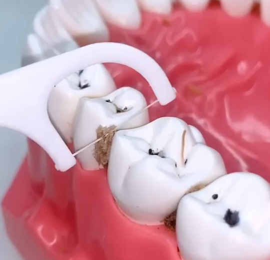  Tooth Cleaning Kit thumbnail