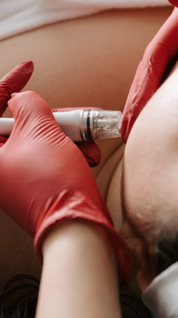 TREAT NOW & PAY LATER WITH CHERRY thumbnail