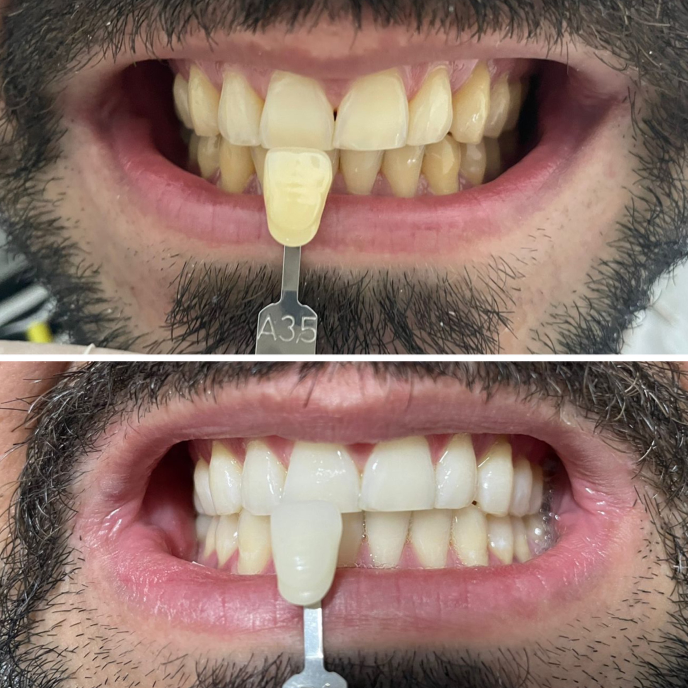 CLAREAMENTO DENTAL thumbnail