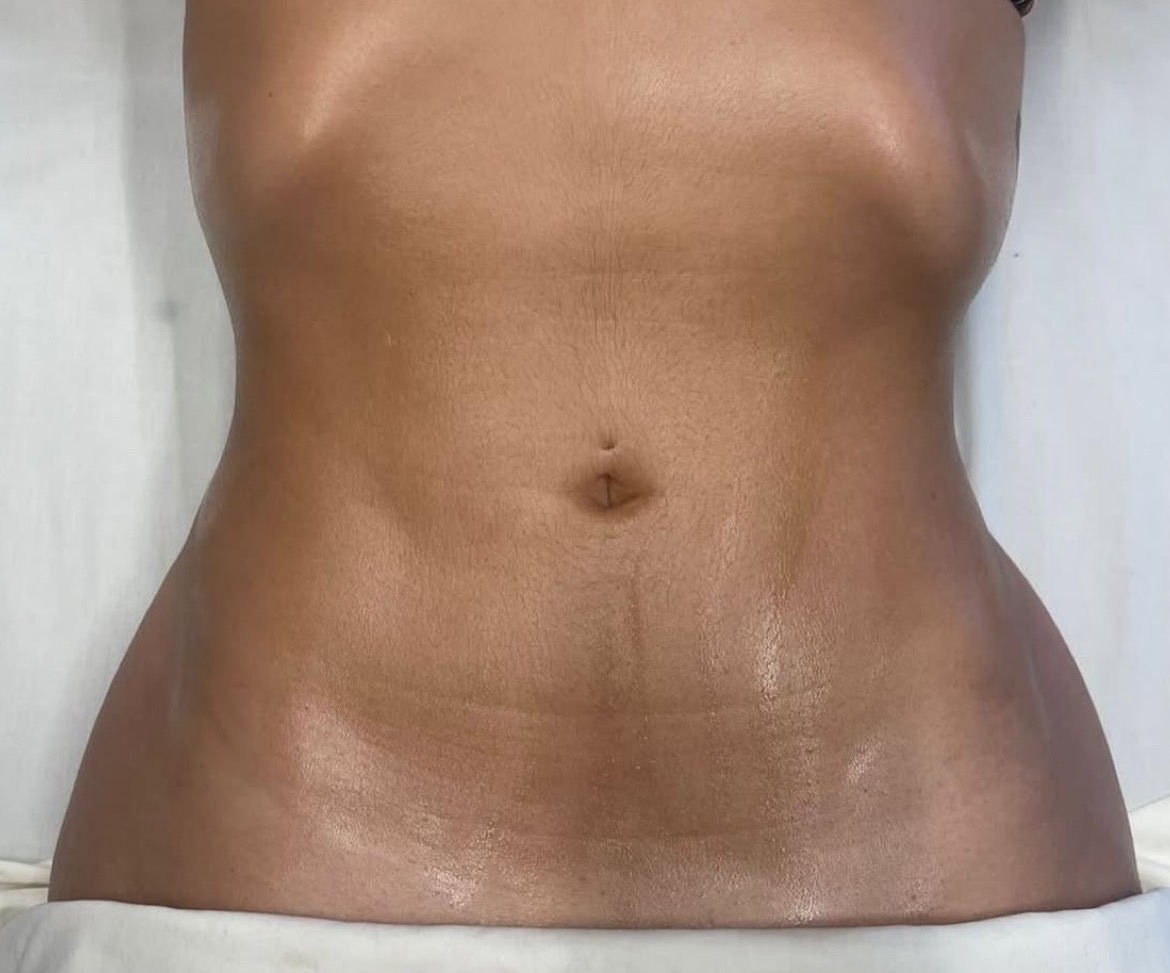 Atendimento Domiciliar : Drenagem Linfática  thumbnail