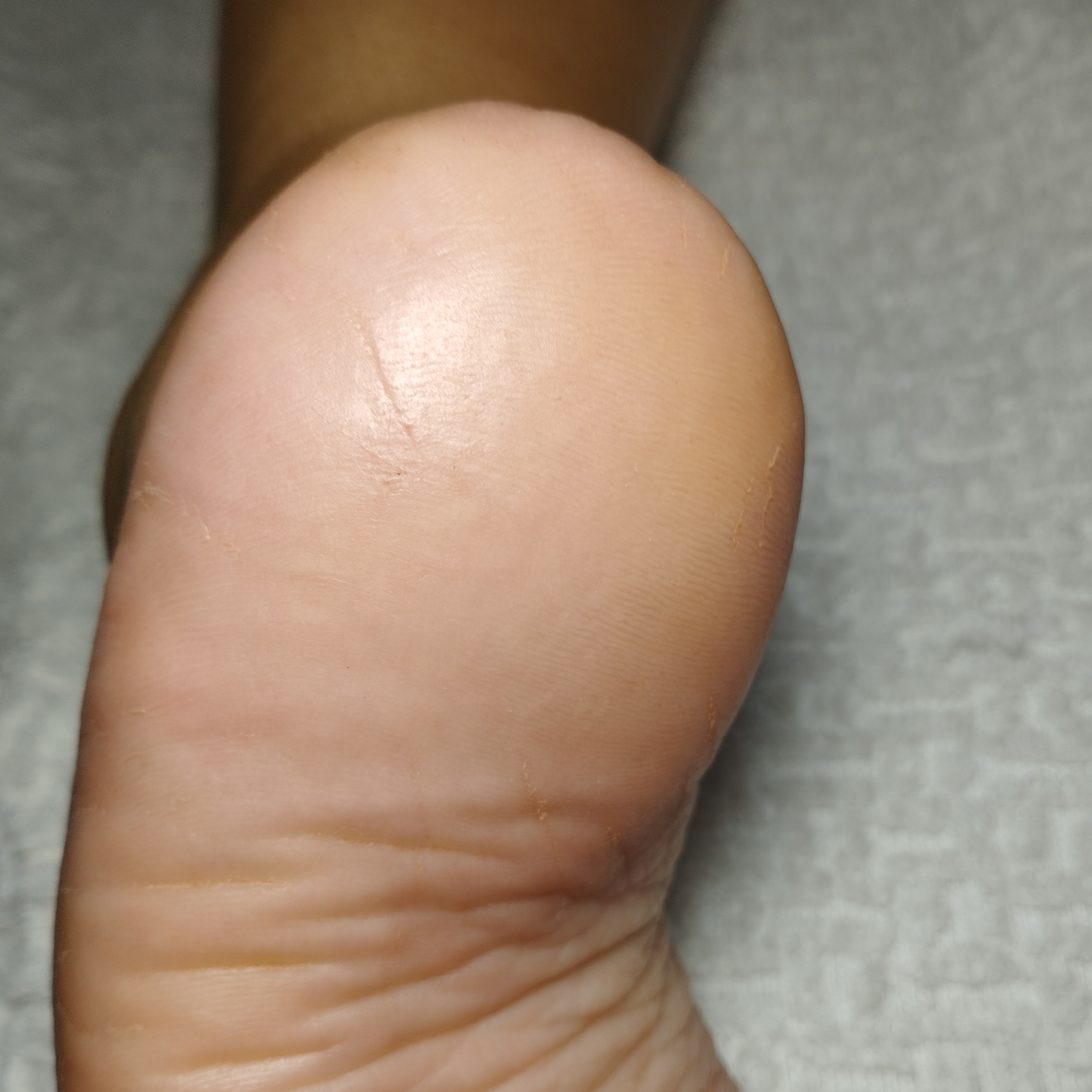 Spa dos pés  thumbnail