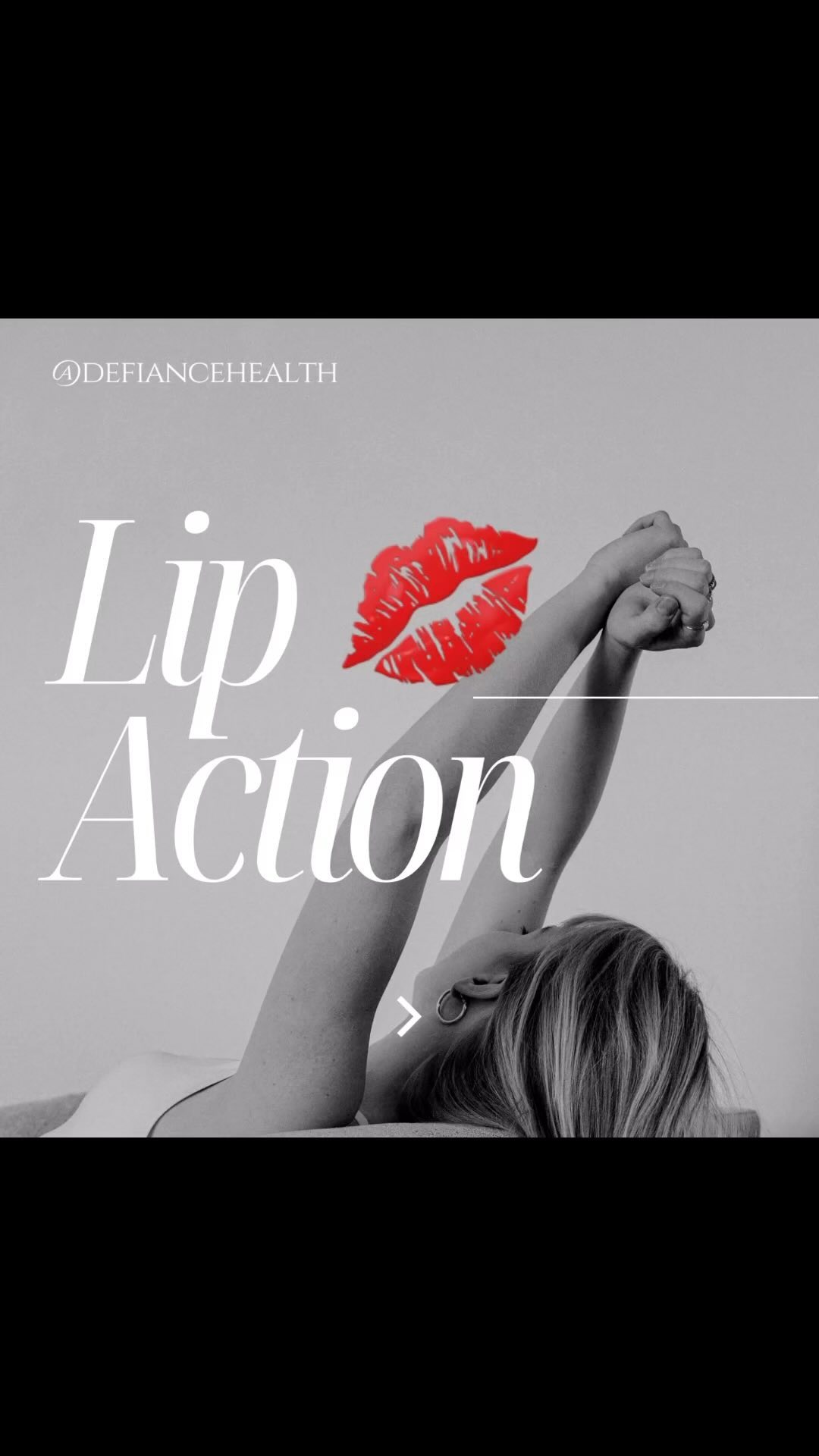 🐺 There are levels to the lip game! 💋 

At Defiance Health we offer multiple approaches to lip enhancement - your treatm