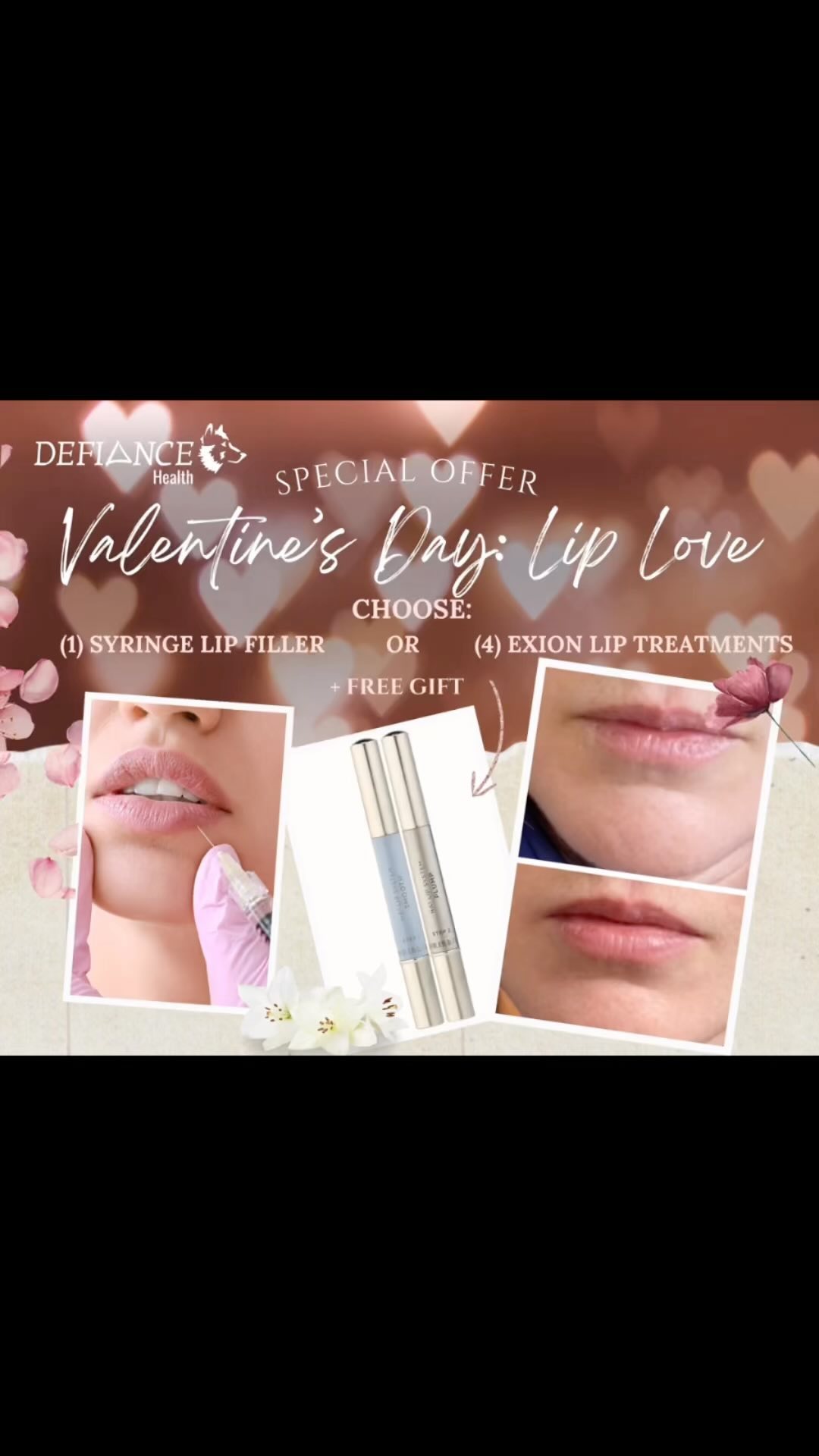 🐺 💋Lip love promo: good through Valentine’s Day 2024! 

Get your free gift & chosen treatment right away or *BIG HINTS* 