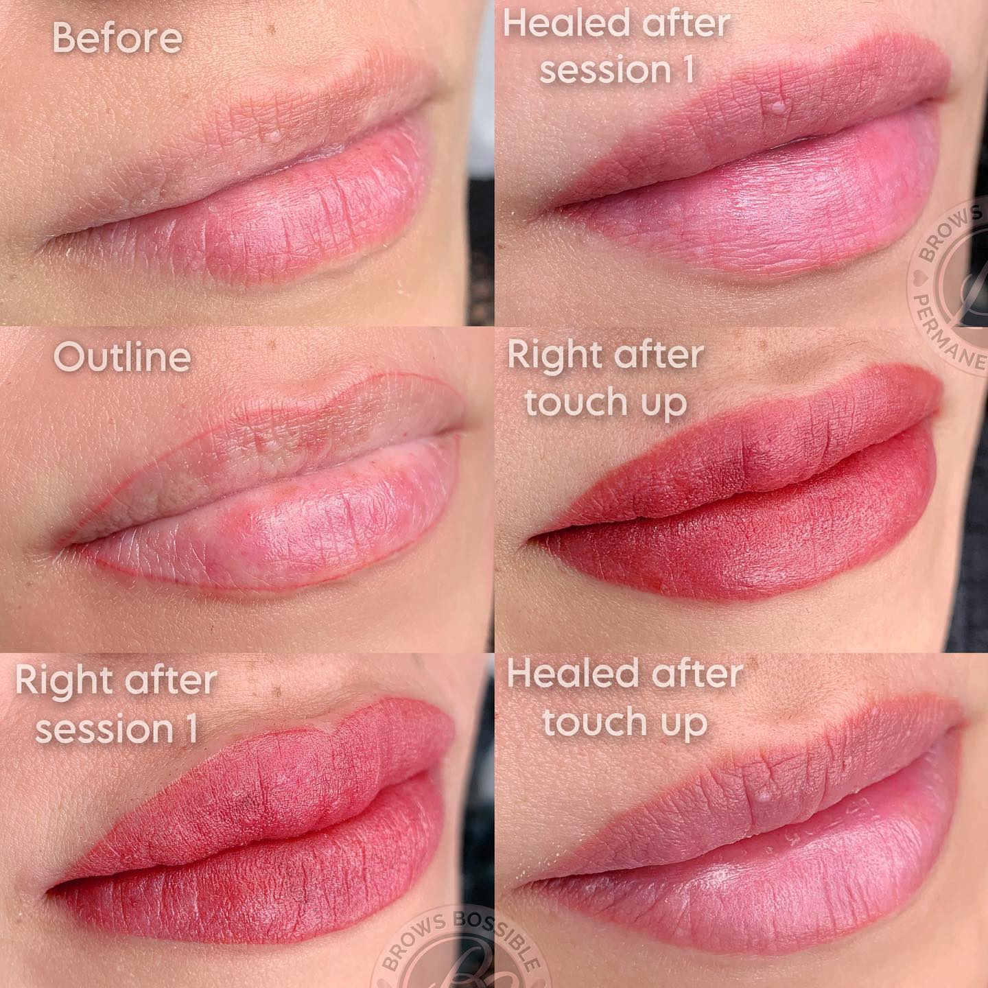 𝑴𝒂𝒈𝒊𝒄 𝒍𝒊𝒑𝒔 𝒑𝒓𝒐𝒄𝒆𝒅𝒖𝒓𝒆’𝒔 𝒆𝒙𝒑𝒆𝒄𝒕𝒂𝒕𝒊𝒐𝒏𝒔💋

Lips Blush is an underrated procedure but it delivers serious result 💋

𝑪𝒐𝒍𝒐𝒓 𝒍𝒂𝒔𝒕