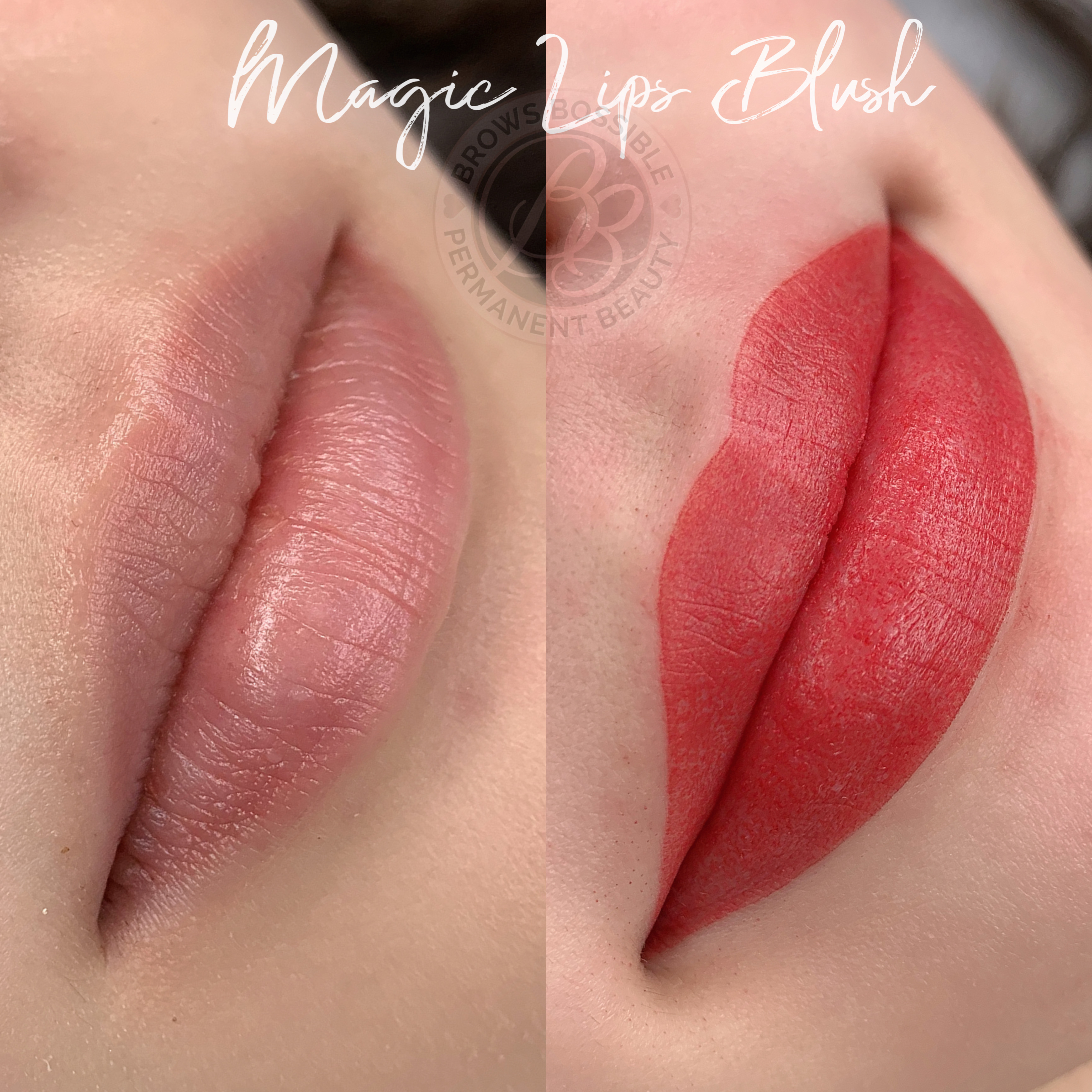 LIPS CONSULTATION thumbnail