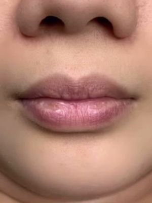 Lips Blush Healing Process #lipstattoo #permanentlips #pmulips  #lipsblushatlanta #permanentlipstick #atlpmu