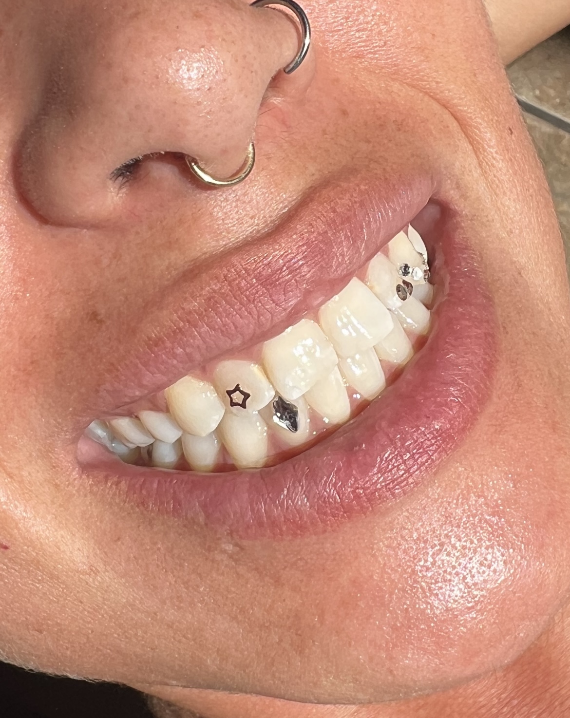Tooth Gems thumbnail