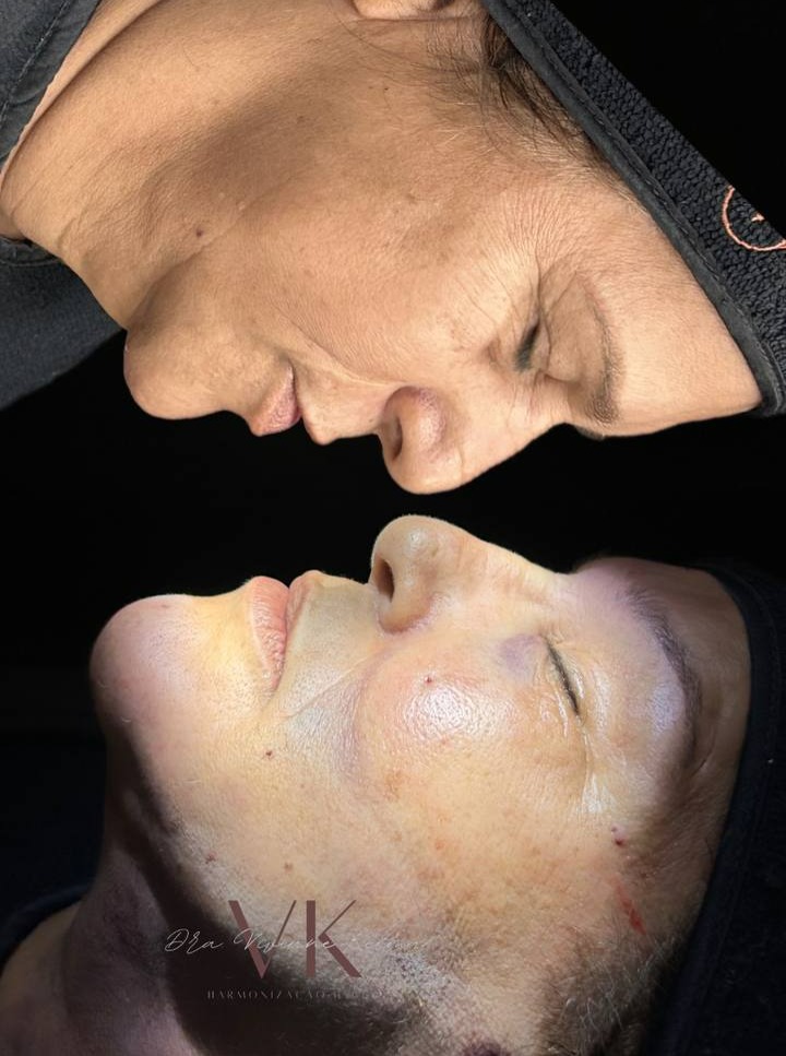 MARCAR NO  RIO MAR  RECIFE TORRE 3 thumbnail