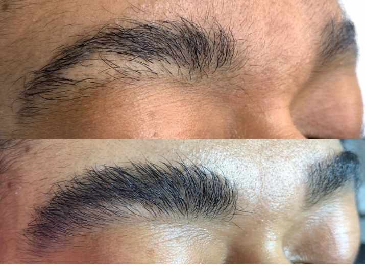 Projeto Frida thumbnail