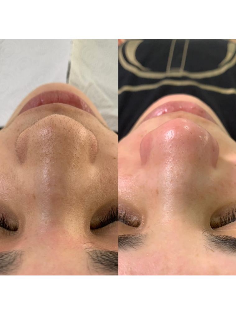 Limpeza de Pele thumbnail