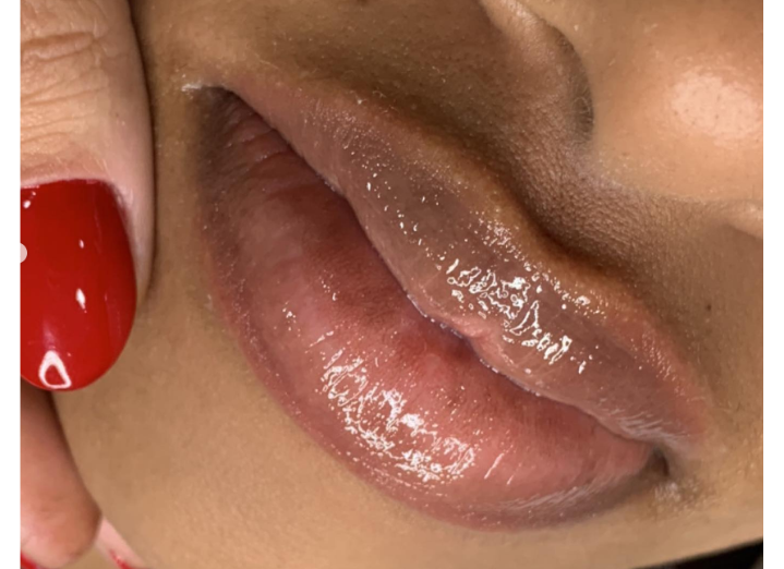 Hidragloss thumbnail