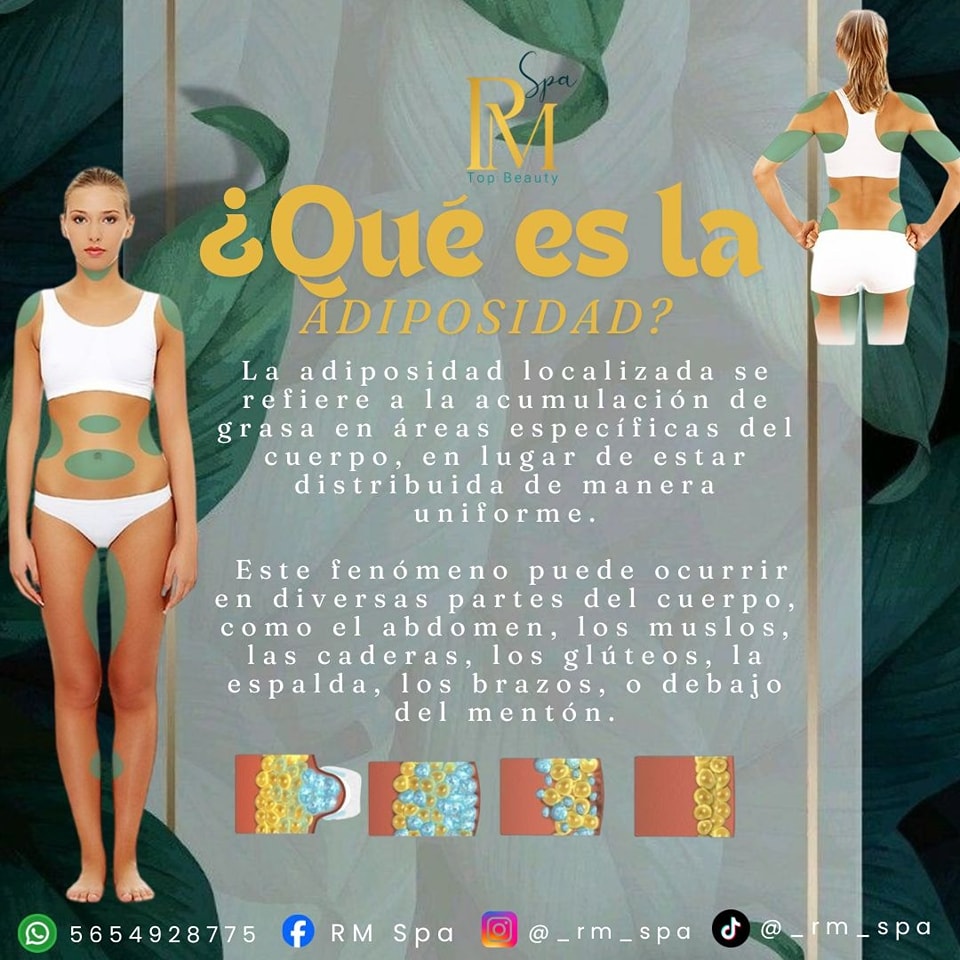 ¡Dile adiós 🖐🏾 a la adiposidad localizada y saluda a una figura esculpida con nuestros tratamientos avanzados! 👙🩱🩳

En R