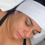 Facial Profundo  thumbnail