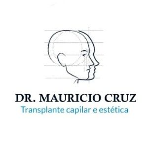 TRANSPLANTE CAPILAR Aux Milena Gonçalves  thumbnail