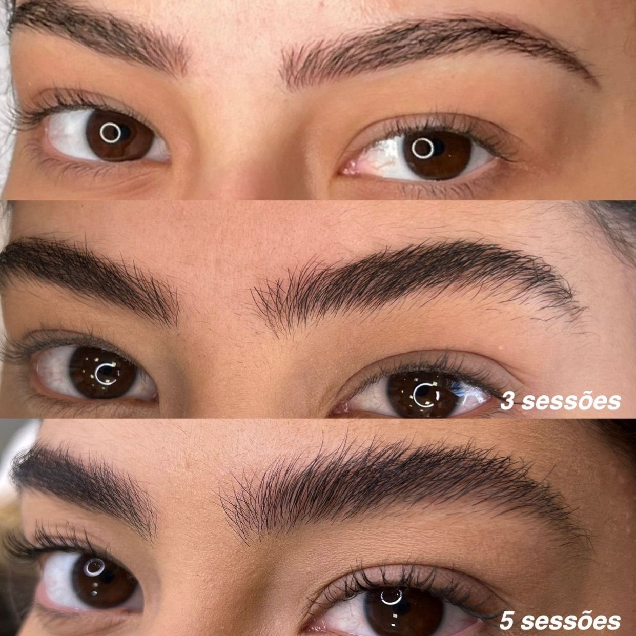 Fort brows thumbnail