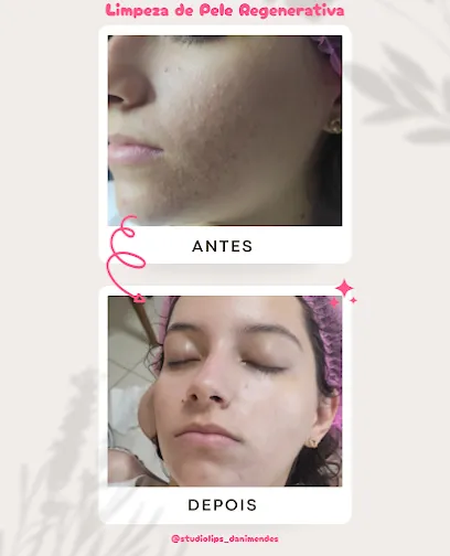 Antes e Depois thumbnail