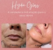 Antes e Depois thumbnail