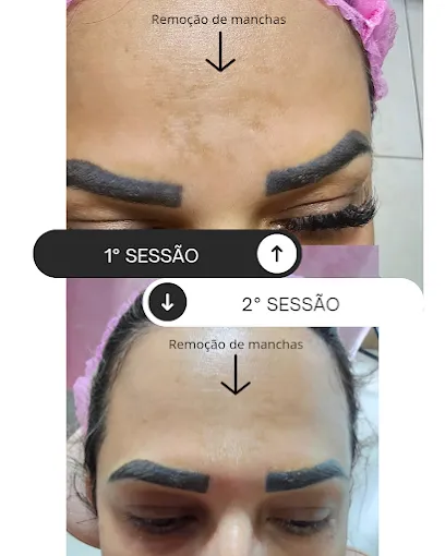 Antes e Depois thumbnail