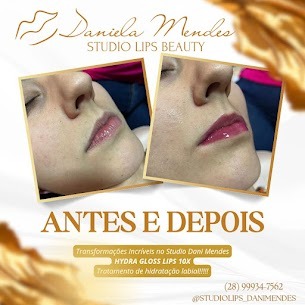 Antes e Depois thumbnail