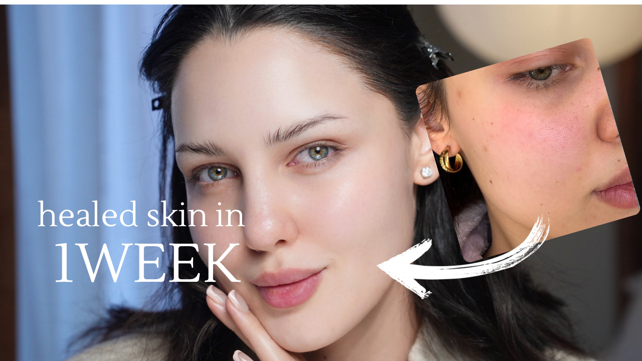 How I healed my skin barrier in * 1 WEEK* thumbnail