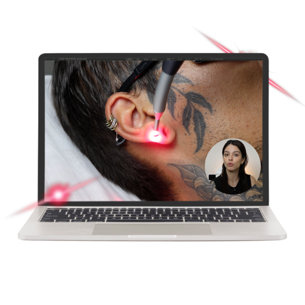 CURSO —   Laserterapia (com certificado) thumbnail