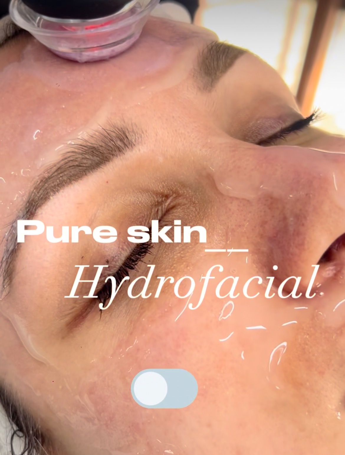 Book your skin consultation/facial treatments here - Sknillusion  thumbnail