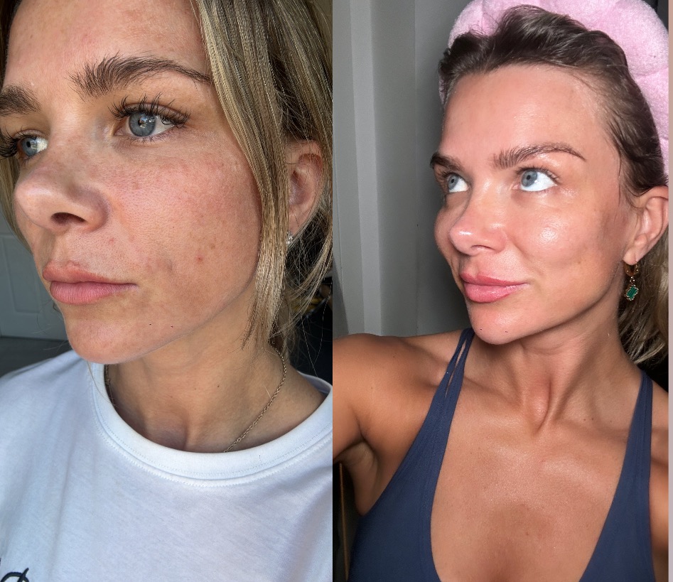Glass skin - full routine skincare package  thumbnail