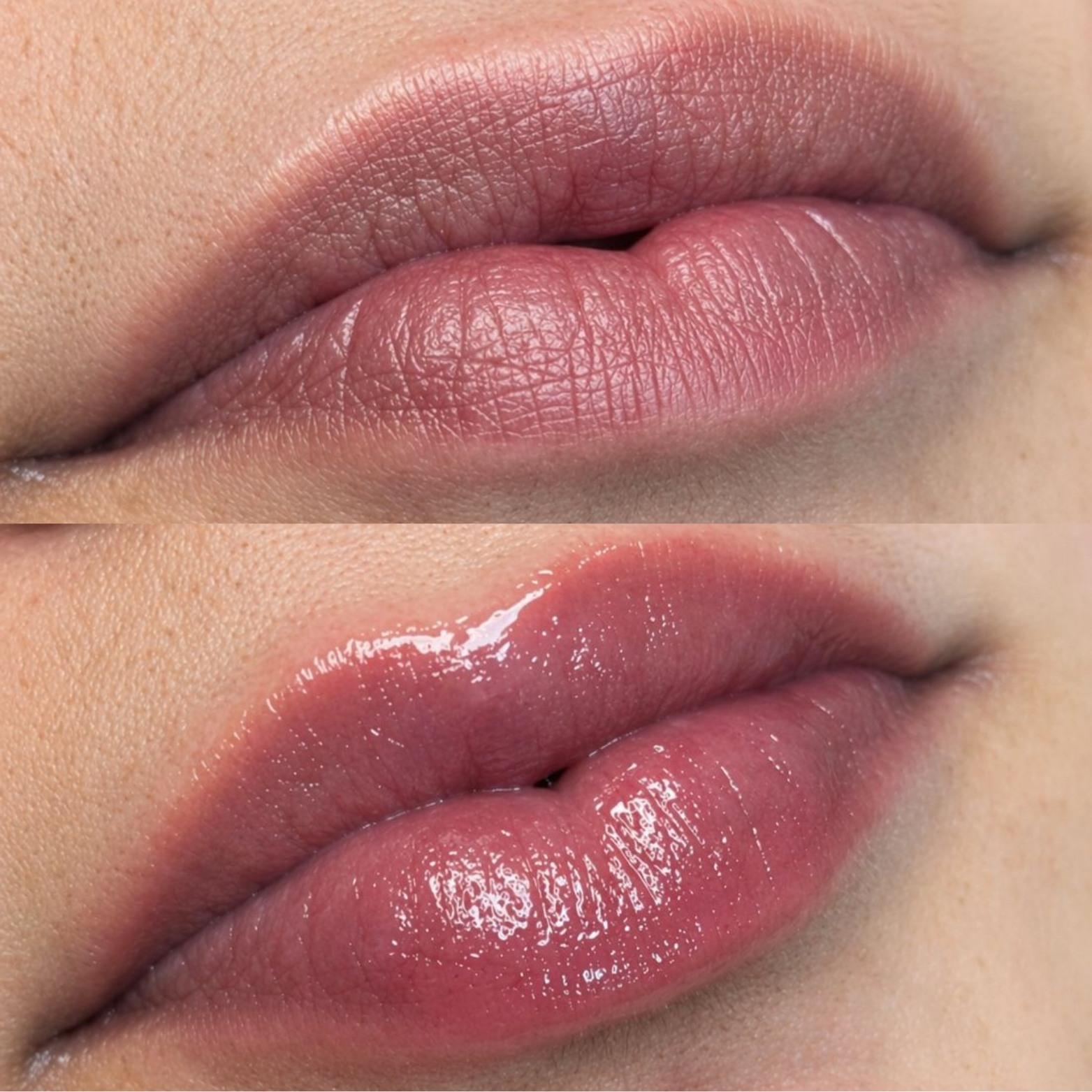 SPA Labial thumbnail