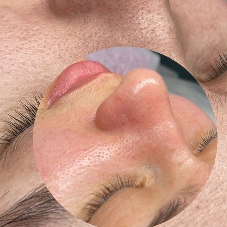 Limpeza De Pele thumbnail