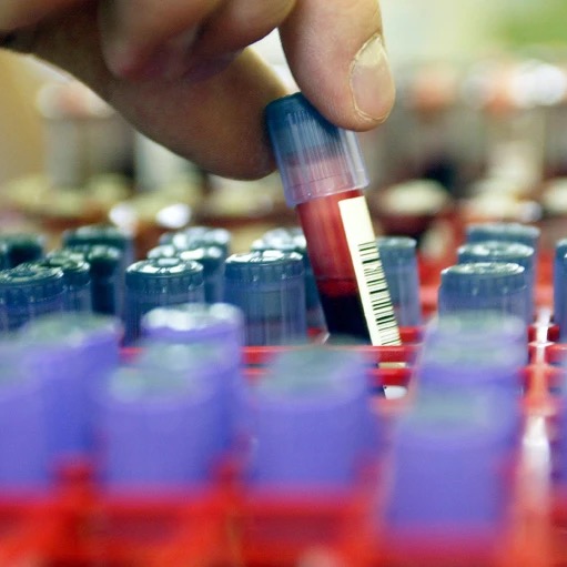 Blood test could help diagnose bipolar disorder — but some researchers are sceptical thumbnail