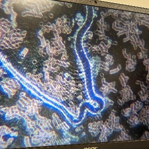 What is blood analysis? thumbnail